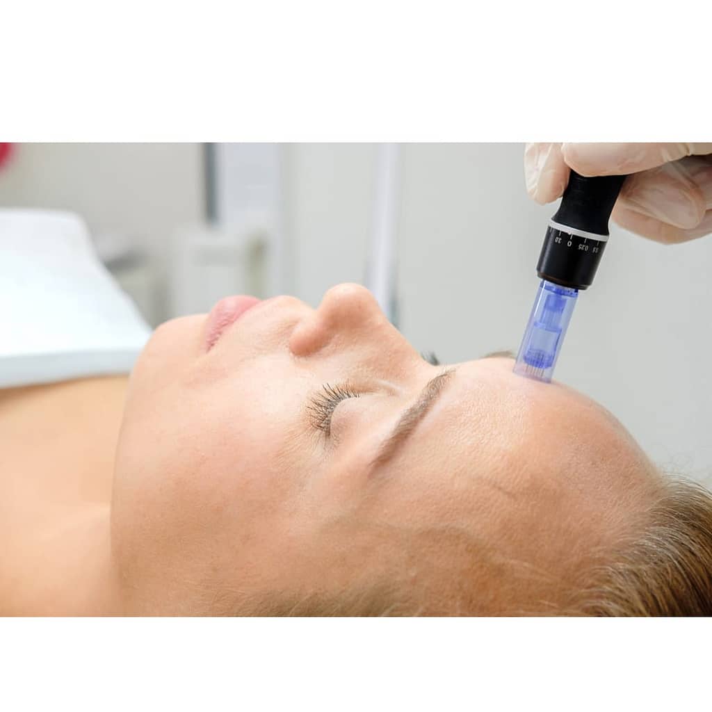 Microneedling-Master-Course