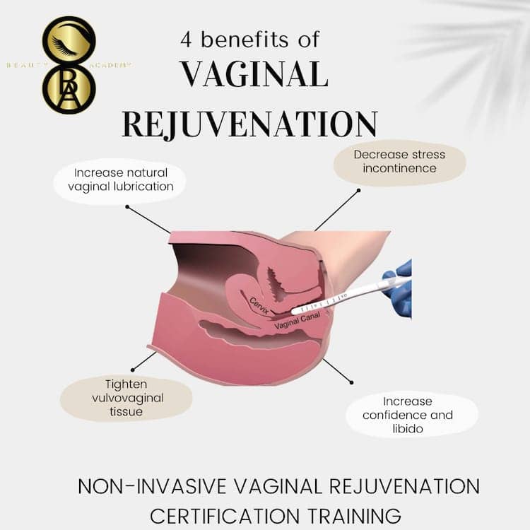 Non-Invasive Vaginal Rejuvenation Certification Training
